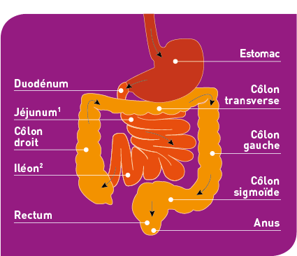 Schéma colostomie