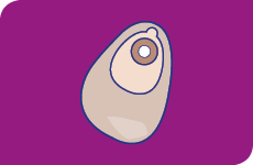 Appareillage 1 pièce colostomie
