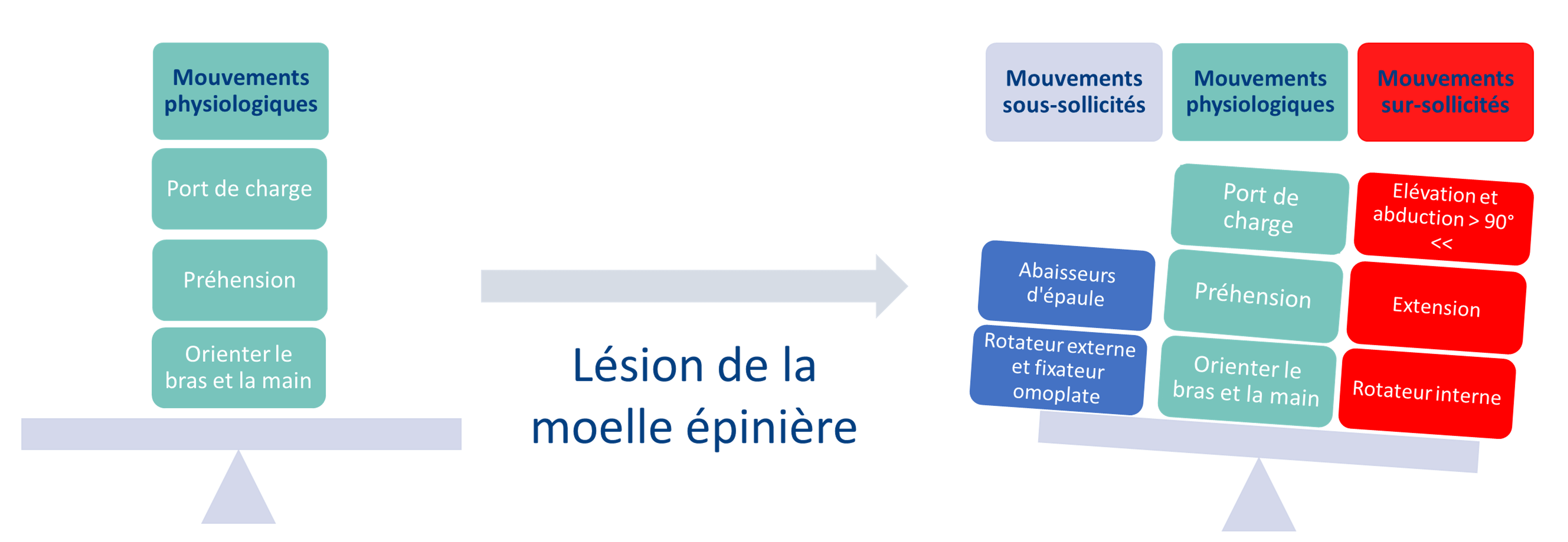 art_V2_les_douleurs_depaules_comment_les_prevenir image Lésion de la moelle épinière