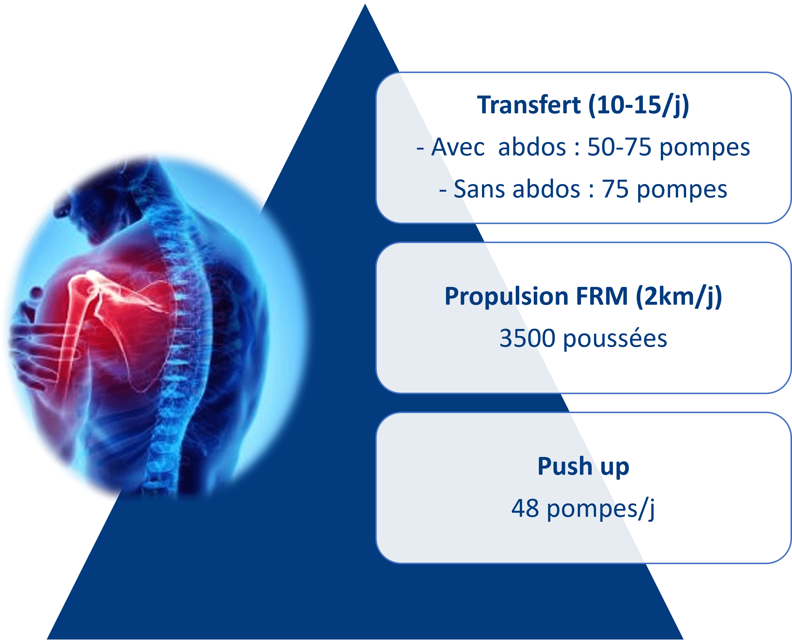 art_V3_les_douleurs_depaules_comment_les_prevenir image douleurs épaules