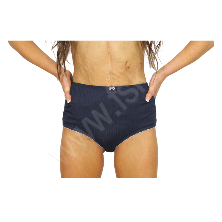 Pack de 3 culottes Sous Vêtement pour Stomisés