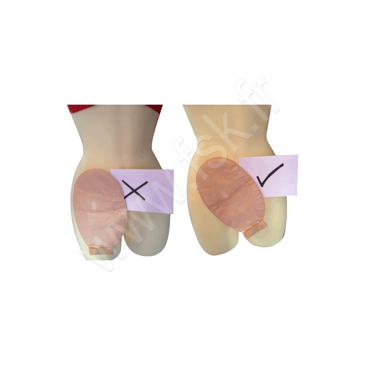 Pack de 3 culottes Sous Vêtement pour Stomisés