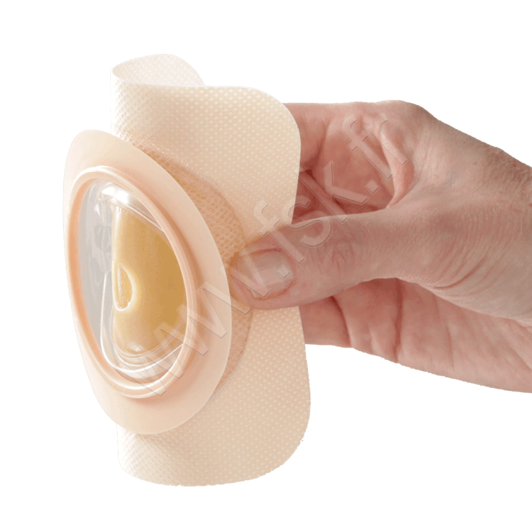 Support Natura Modelable à Soufflet Dura Stomie Digestive