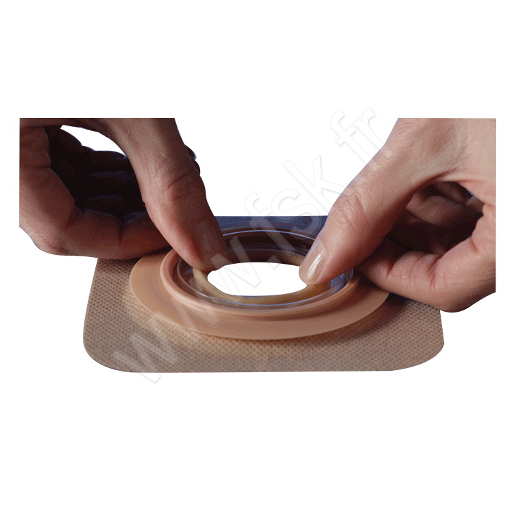 Support Natura Modelable à Soufflet Dura Stomie Digestive