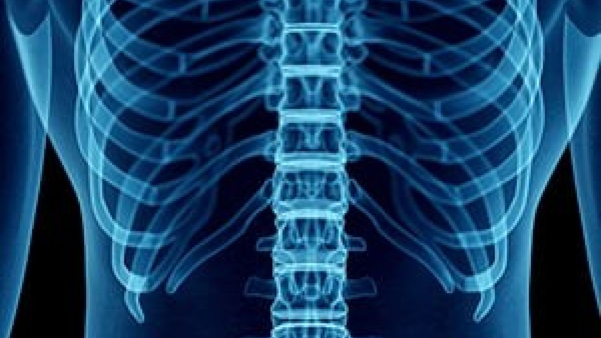 Pour_comprendre_votre_l%C3%A9sion_m%C3%A9dullaire_vous_devez_dabord_mi-0cb8b53e Vous souhaitez jouer au tennis ? Apprenez &agrave; jouer au tennis en fauteuil roulant