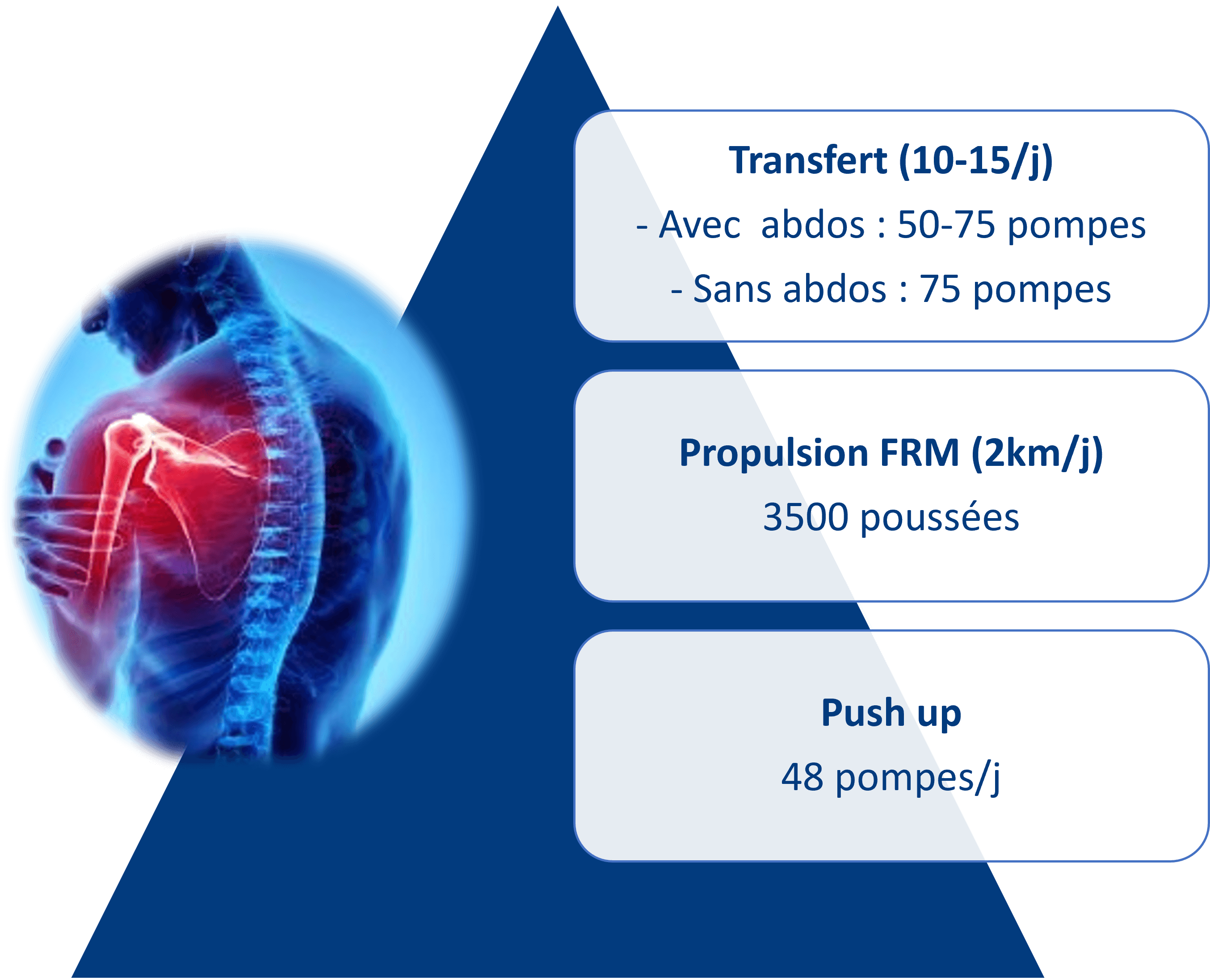 douleurs &eacute;paules